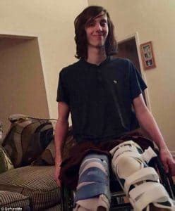 jacob ohl|Gwinnett teen suing CSX after train accident severed his legs